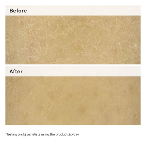 Before and After close-up images of skin. The 'Before' image shows very dry, cracked skin. The 'After' image shows the skin is visibly smoother and more hydrated, demonstrating the body lotion's effectiveness.